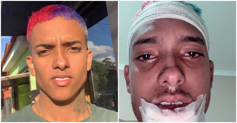 MC Brinquedo sofreu um acidente de moto - Reprodução/Instagram