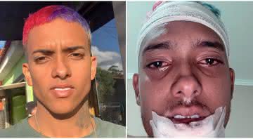 MC Brinquedo sofreu um acidente de moto - Reprodução/Instagram