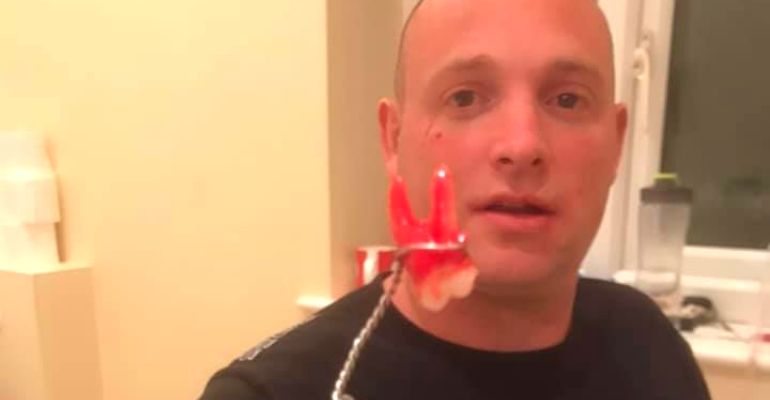 Homem arranca o próprio dente após não conseguir atendimento durante a quarentena