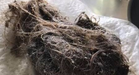 Australiana descobre causa inusitada do entupimento de ralo do banheiro e viraliza na web