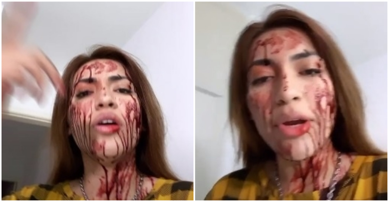 Youtuber Dani Russo aparece ensanguentada e assusta fãs; entenda