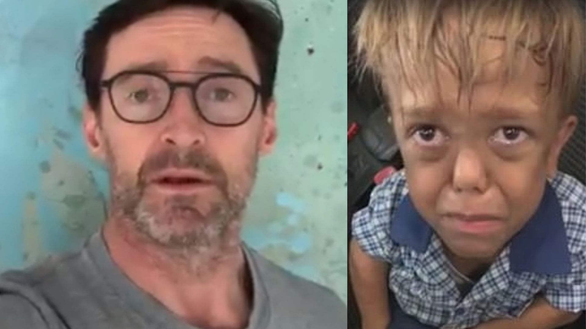 Hugh Jackman defende criança anã que sofreu bullying na escola