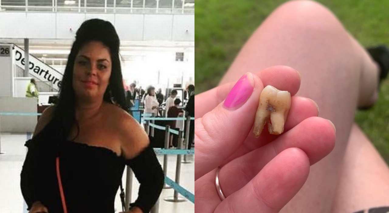 Sem dentista na quarentena, mulher fica embrigada e arranca o próprio dente