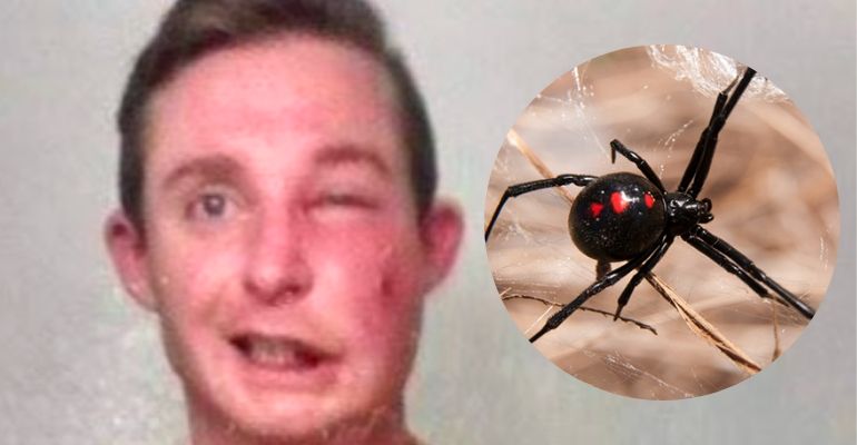 Homem quase fica cego após ser picado por aranha selvagem enquanto dormia