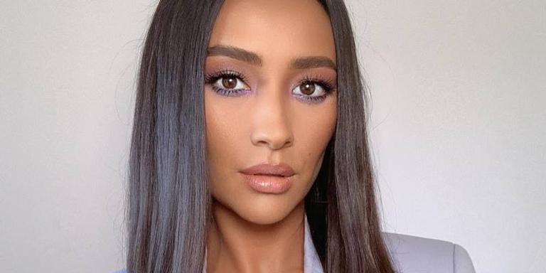 Shay Mitchell perde dente e compartilha com seus seguidores