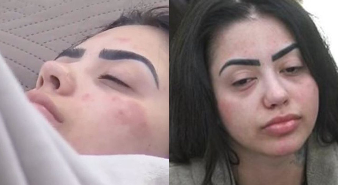 A Fazenda 12: Após crise alérgica, aparência de MC Mirella preocupa fãs: “Cadê a produção?”