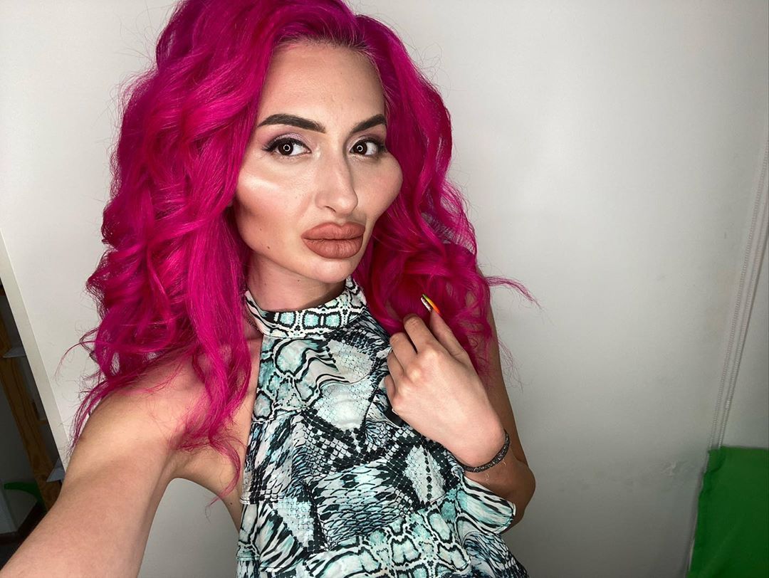 Modelo gasta mais de R$ 10,5 mil com obsessão por preenchimento nas maçãs do rosto