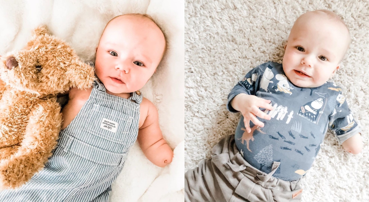 Aos 11 meses de vida, bebê com deficiência no braço é sucesso nas redes sociais