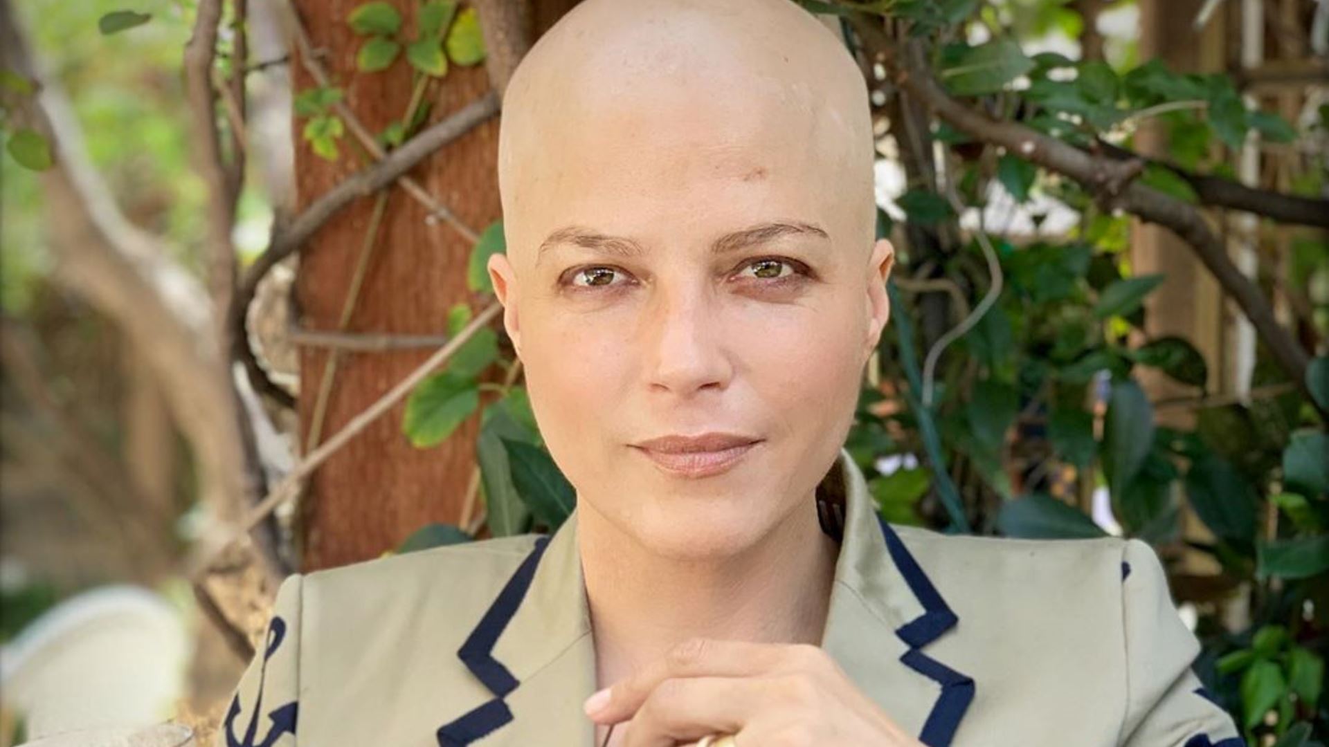 Selma Blair, de Segundas Intenções, é diagnosticada com esclerose múltipla e revela problemas de visão: ”Pânico”
