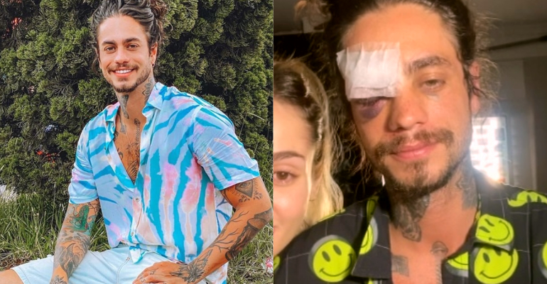 Thiago Consani, do De Férias Com o Ex, esclarece acidente de moto: “Estava indo trabalhar”